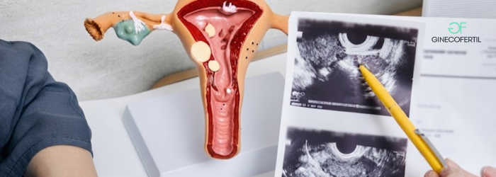 Recanalización tubaria: opciones médicas para restaurar la fertilidad
