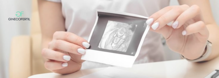 Esperanza realista en tratamientos de fertilidad: cómo vivir el proceso con claridad y confianza