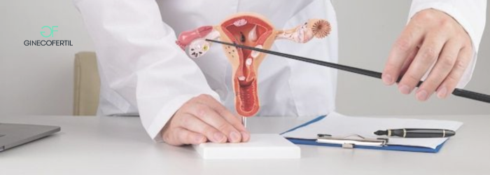 Recanalización de trompas después de 10 años de ligadura: opciones reales en fertilidad