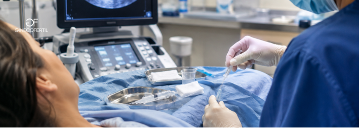 Inseminación artificial: Guía completa sobre cómo se prepara el proceso para buscar tu embarazo.
